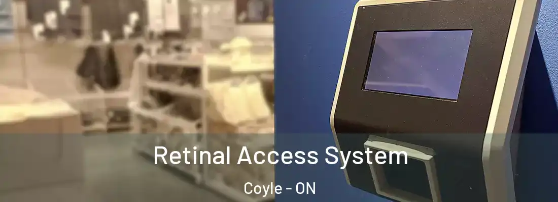  Retinal Access System Coyle - ON